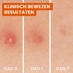 Bioré 3-in-1 Anti Spot Patches 24 stuks