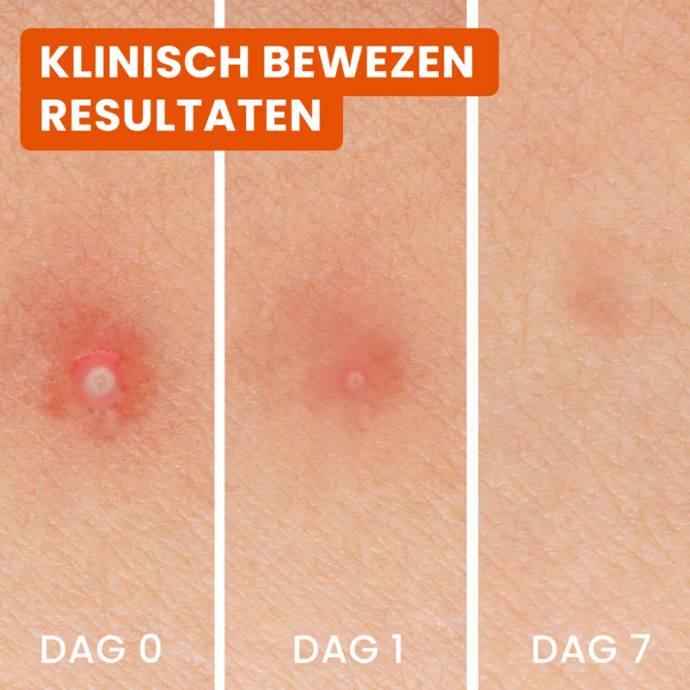 Bioré 3-in-1 Anti Spot Patches 24 stuks