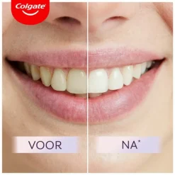 Colgate Tandpasta Max White Ultimate 75 ml