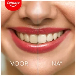 Colgate Tandpasta Max White Ultra Freshness Pearls 75 ml