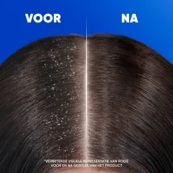 Head & Shoulders 2in1 Classic 300 ml