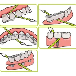 iDontix X-Floss 30 stuks