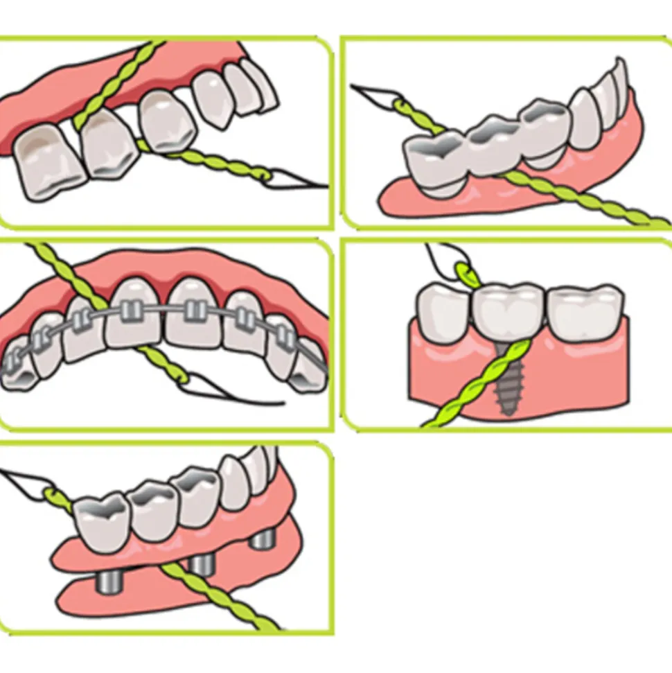 iDontix X-Floss 30 stuks
