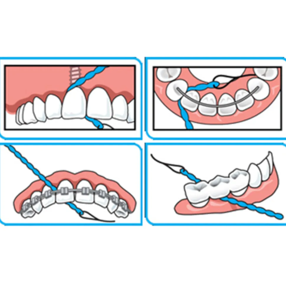 iDontix X-Floss Lite 30 stuks