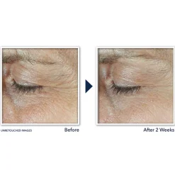 RoC Derm Correxion Dual Eye Cream 20 ml