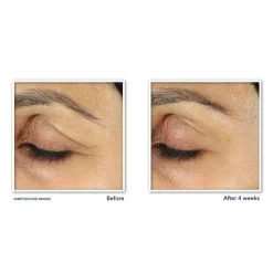 RoC Retinol Correxion Line Smoothing Oogcrème 15 ml