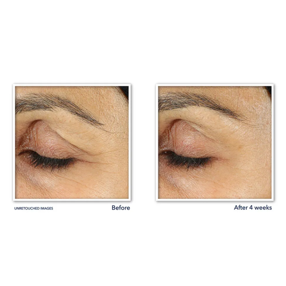RoC Retinol Correxion Line Smoothing Oogcrème 15 ml