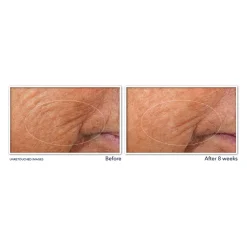 RoC Retinol Correxion Serum Nacht 10 stuks