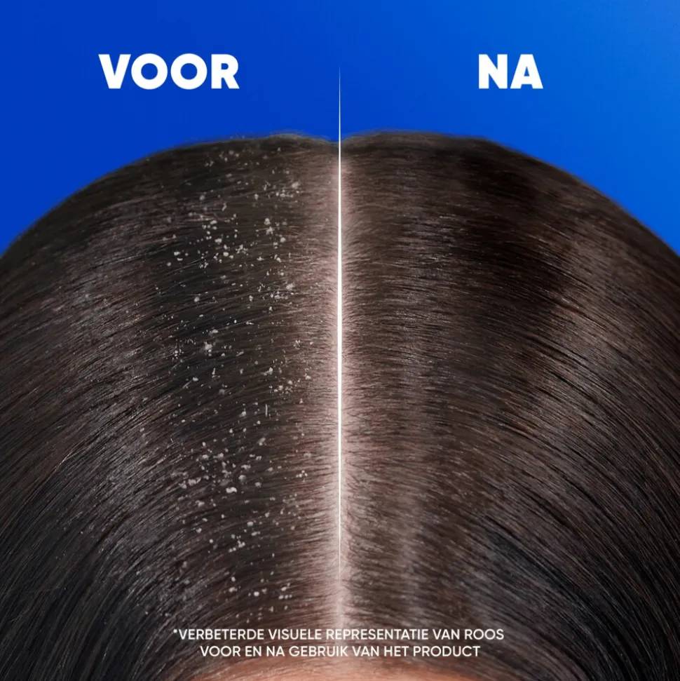 6x Head & Shoulders 2in1 Apple Fresh 300 ml